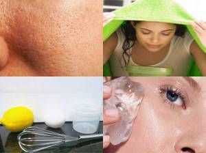 Нүхжилтыг хэрхэн амархан арилгах вэ?